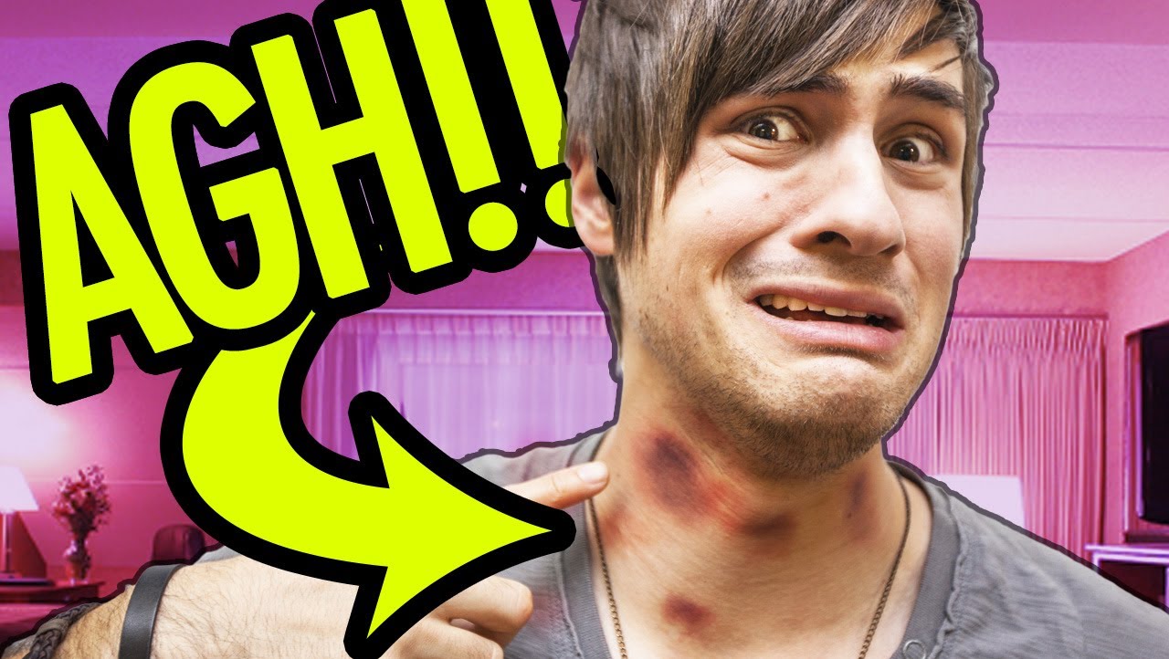 SO MANY HICKEYS!, Smosh Wiki