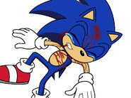 Sonic is really hurt