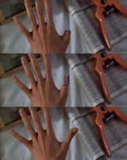 Sil regenerates her thumb