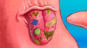 Close-up of Patrick's tongue