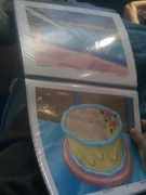 Pre-release image of the "Sorry about the Scabies" cake for Patrick, censoring "Scabies" as not to ruin the joke[2]