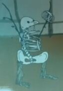Billy's Morton's Skeleton