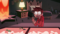 S2E3 Marco Diaz with a bruised hand