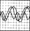 EKG Dralasite