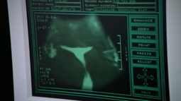 Ovary