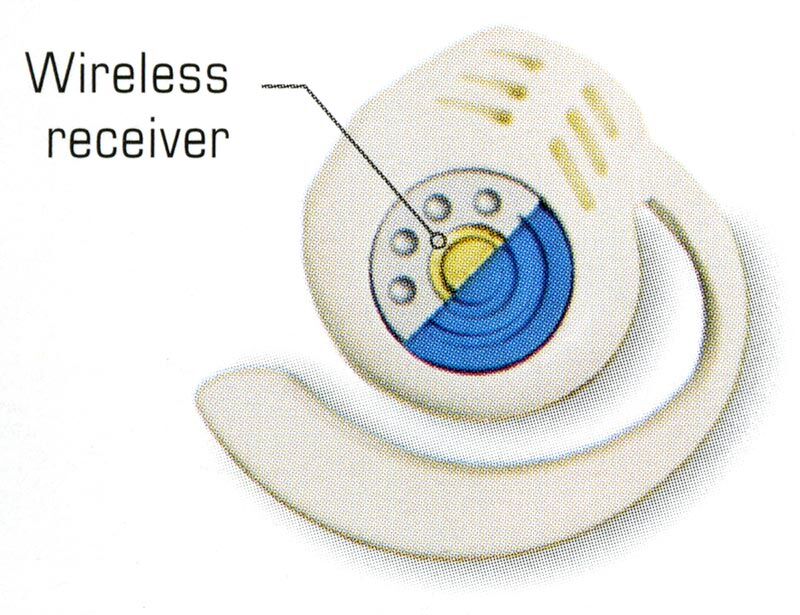 Feinberg receiver 22nd century.jpg