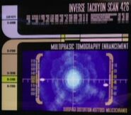 Sensor scan of the anti-time distortion.