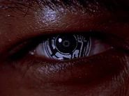 Ocular implant.jpg (11 KB)