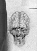 Limbic-Drawing-Baker