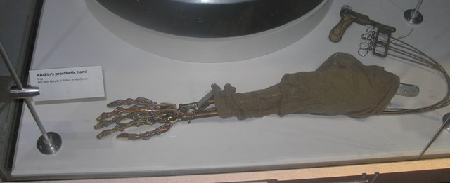 Anakin's prosthetic hand as seen at the Star Wars exhibit. This was displayed near a stand with medical connections to our world.