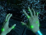 Kharaa-Bakterium