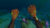 Ryley's infected hands in the normal dive suit