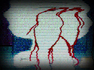 Squidwardcryingblood.png