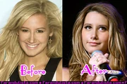 Ashley-tisdale-new-nose-001