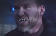 Benny's vampire fangs.