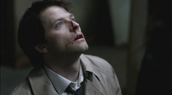 Castiel beaten up by Uriel