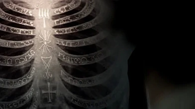 Dean shows Sam the "glamour shot" of the Enochian warding etched into his ribcage by Castiel.