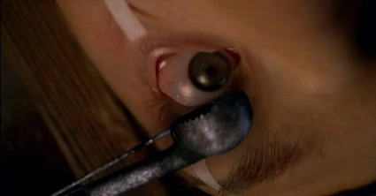 Doc Benton prepares to harvest Sam's eye with a hot melon baller.