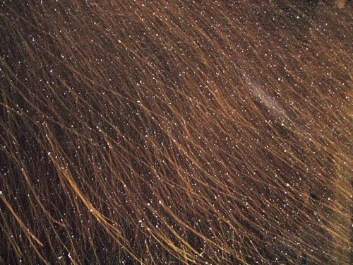 7 фактов о вшах, о которых вы, вероятно, не хотите знать