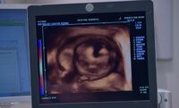 S03E20-Ultrasound
