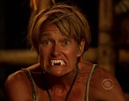 DawnNoTeethAftc.jpg (42 KB) Dawn with her false teeth out during the Final Tribal Council.