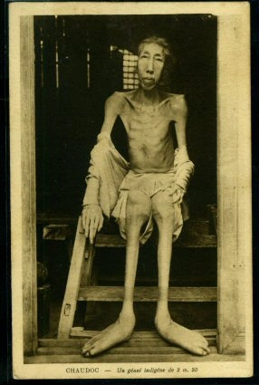 Mystery giants | Tallest People Wiki | Fandom