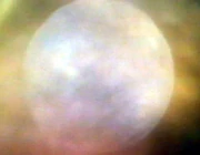 The Planet around the P7E