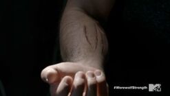 4x06 Accelerated healing derek