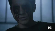 Tyler-Posey-Scott-McCall-Blinded-in-Teen-Wolf-Season-6b-Episode-20-The-Wolves-of-War