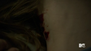 Teen Wolf Season 5 Episode 11 The Last Chimera Claw Marks in Lydia's Neck