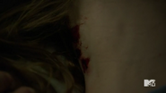 Teen Wolf Season 5 Episode 11 The Last Chimera Claw Marks in Lydia's Neck