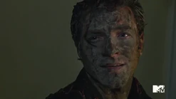 No really they say the worms are really good for the skin