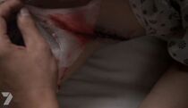 Lydia's Wound