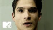 Teen Wolf 'Operating Table' Official Promo (Season 5) MTV-0