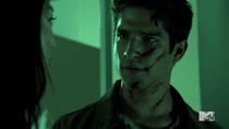 Teen Wolf Season 4 Episode 10 Monstrous Scott streaked with blood