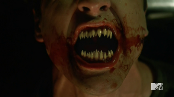 Teen Wolf Season 5 Episode 4 Condition Terminal Donovan new teeth 