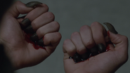 Dylan-Sprayberry-Liam-claws-Teen-Wolf-Season-6-Episode-11-Said-the-Spider-to-the-Fly