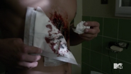 Teen Wolf Season 5 Episode 12 Damnatio Memoriae Wounded Scott