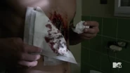 Teen Wolf Season 5 Episode 12 Damnatio Memoriae Wounded Scott.png (1,013 KB)