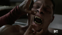 Teen Wolf Season 4 Episode 7 Weaponized sick beta