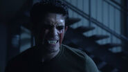 Tyler-Posey-Scott-bloody-eyes-Teen-Wolf-Season-6-Episode-20-The-Wolves-of-War