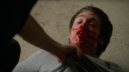 Dylan-Sprayberry-Liam-bleeding-Teen-Wolf-Season-6-Episode-14-Face-to-Faceless