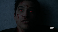 Teen Wolf Season 5 Episode 10 Status Asthmaticus Scott comes back