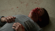 Dylan-Sprayberry-Liam-bloody-mess-Teen-Wolf-Season-6-Episode-14-Face-to-Faceless