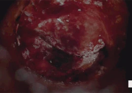 1664f99c8ca146a6c633c734ad8a7fda