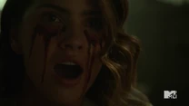 Teen Wolf Season 5 Episode 14 The Sword and the Spirit Malia bleeding.png (536 KB)