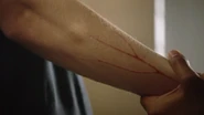 C-J-Hoff-Edgar-red-veins-arm-Teen-Wolf-Season-6-Episode-16-Triggers.png (521 КБ)