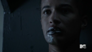 Teen Wolf Season 5 Episode 11 The Last Chimera Noah oozing Mercury