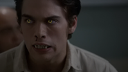 Dylan-Sprayberry-Liam-wolf-eyes-nose-bleed-Teen-Wolf-Season-6-Episode-11-Said-the-Spider-to-the-Fly