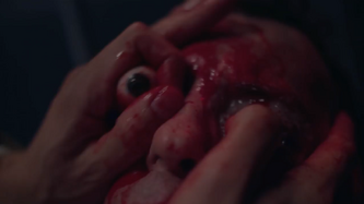 Martinez eye gouge